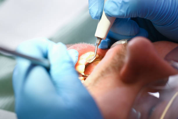 Best Tooth Infection Emergency Dentist  in Merced, CA